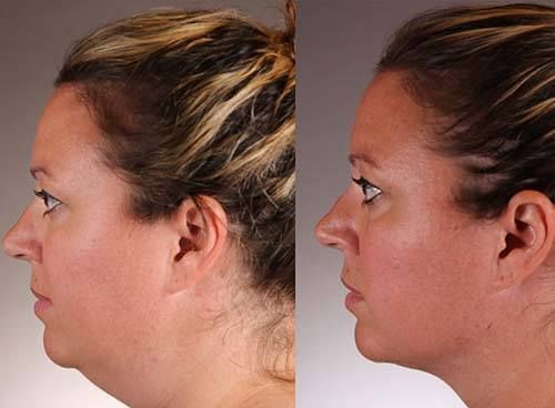 Cover image for Securing a Lifted, Radiant Appearance for Your Family’s Big Day