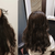Hair Replacement Singapore