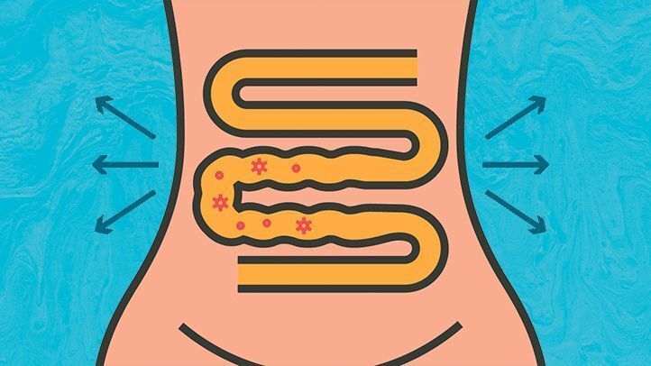 Cover image for Foods to Avoid with Loose Watery Bowel Conditions
